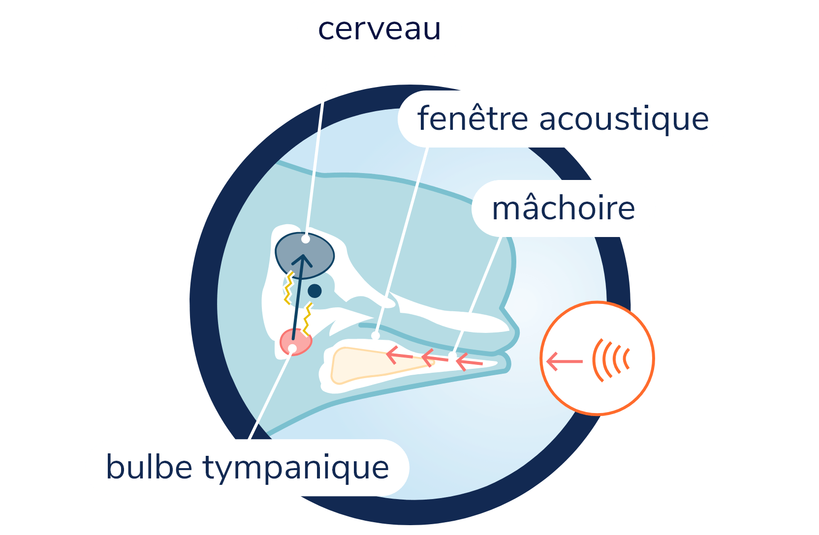 Anatomie du système auditif chez le béluga. La silouhette du béluga et son crâne sont visibles en transparence. Les sons sont perçus par la mâchoire inférieure et traversent la fenêtre acoustique se trouvant à l'intérieur de celle-ci. Les sons sont ensuite transmis au bulbe tympanique situé à la base du crâne. Le bulbe tympanique transmet au signal nerveux jusqu'au cerveau.