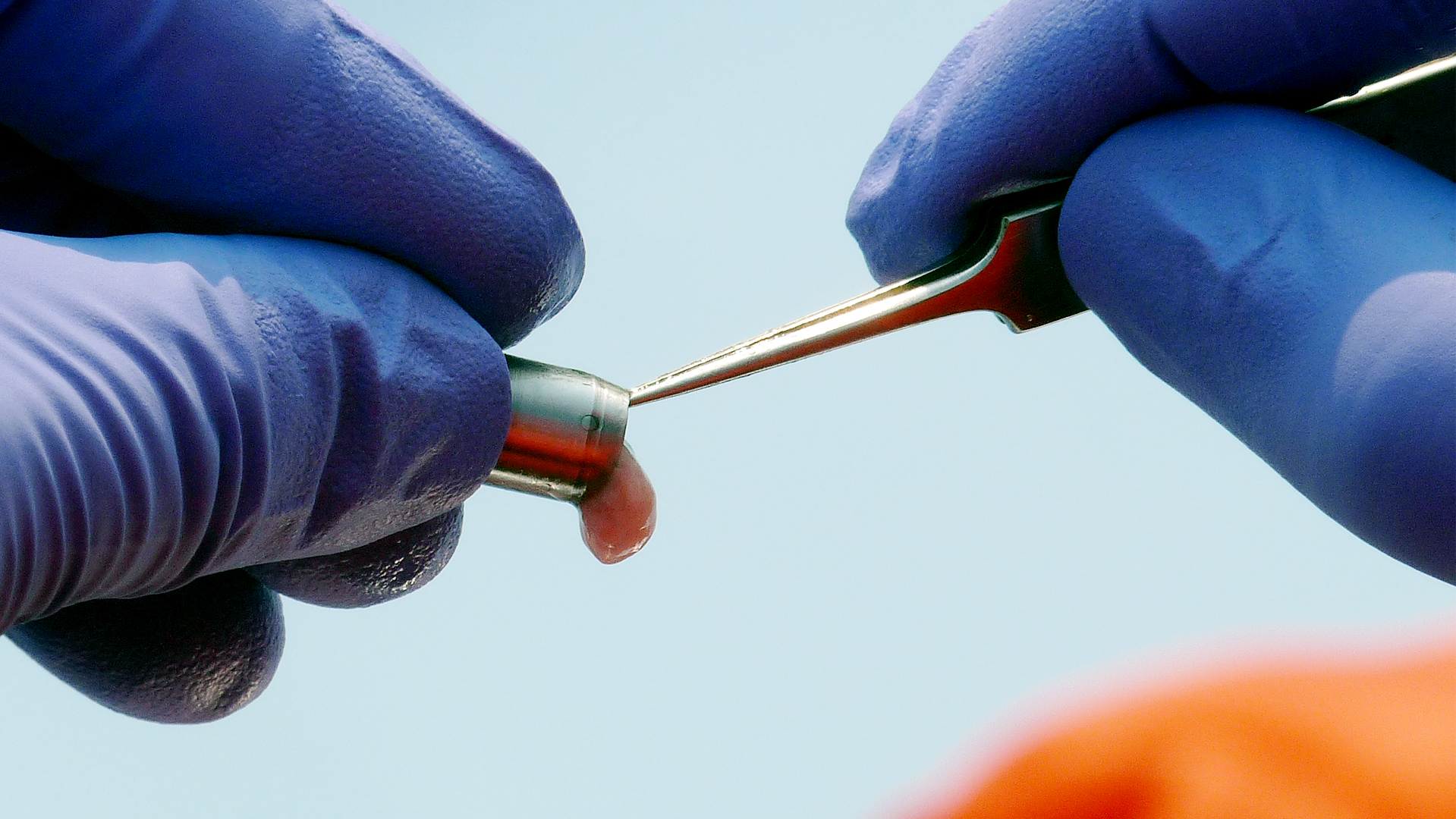 Close-up view of the fingers of a researcher removing the fat and skin sample from a dart using a pair of forceps.